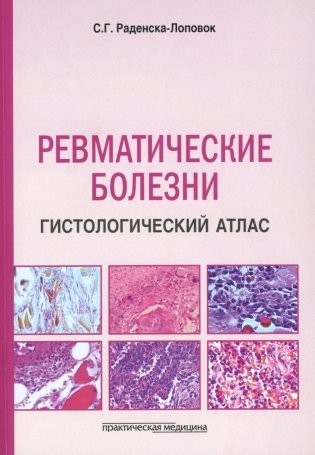 Раденска-Лоповок Ревматические болезни Гистологический атлас