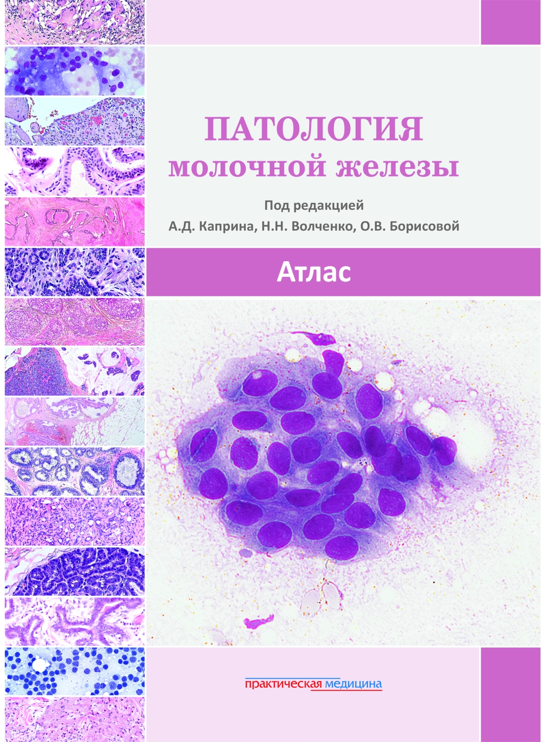 Борисова Патология молочной железы. Атлас
